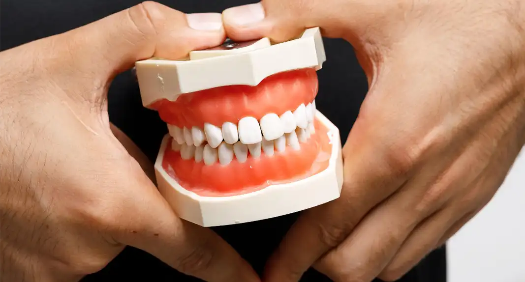 Киста зуба - что это такое? Простыми словами отвечает стоматолог.