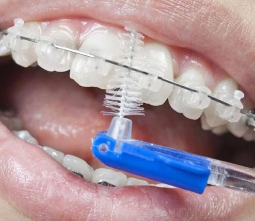 Инструменты для ухода за зубами