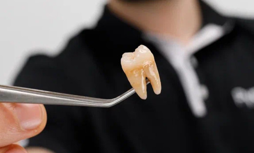 Почему появляется пульпит и как его избежать?