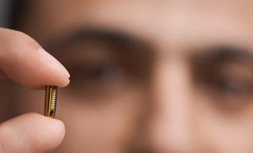 Дентальная имплантация