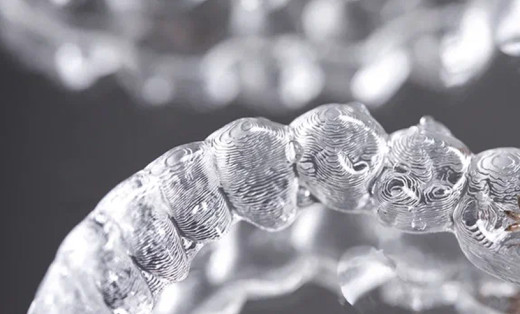 Всё, что вы хотели знать об установке виниров