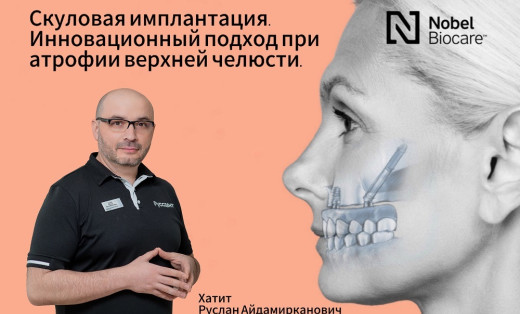 Скуловая имплантация. Инновационный подход при атрофии верхней челюсти.