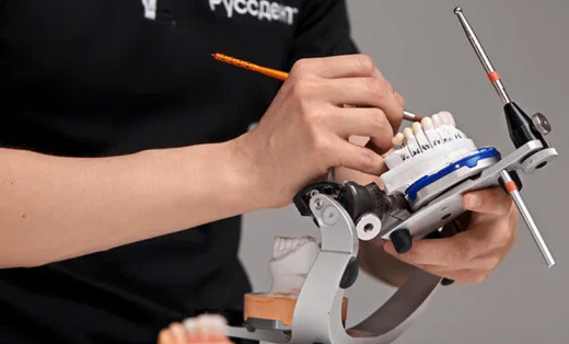 Имплантация зубов: что нужно знать пациенту?