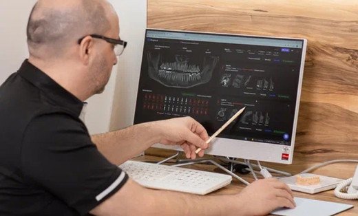 All-on-4 имплантация в Краснодаре