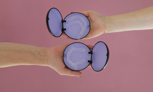 Элайнеры для детей